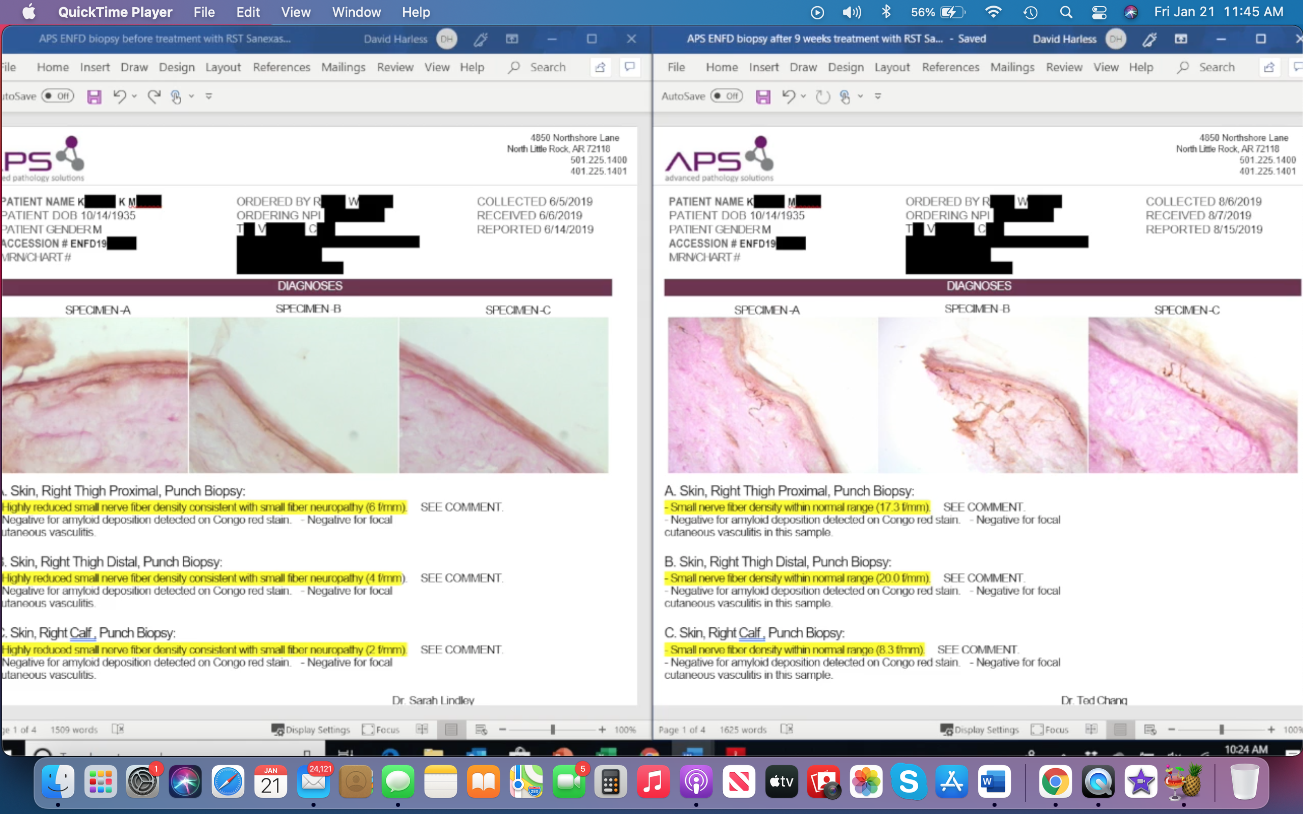 Neuropathy Testimonials Over 200 on this page. This Protocol works!